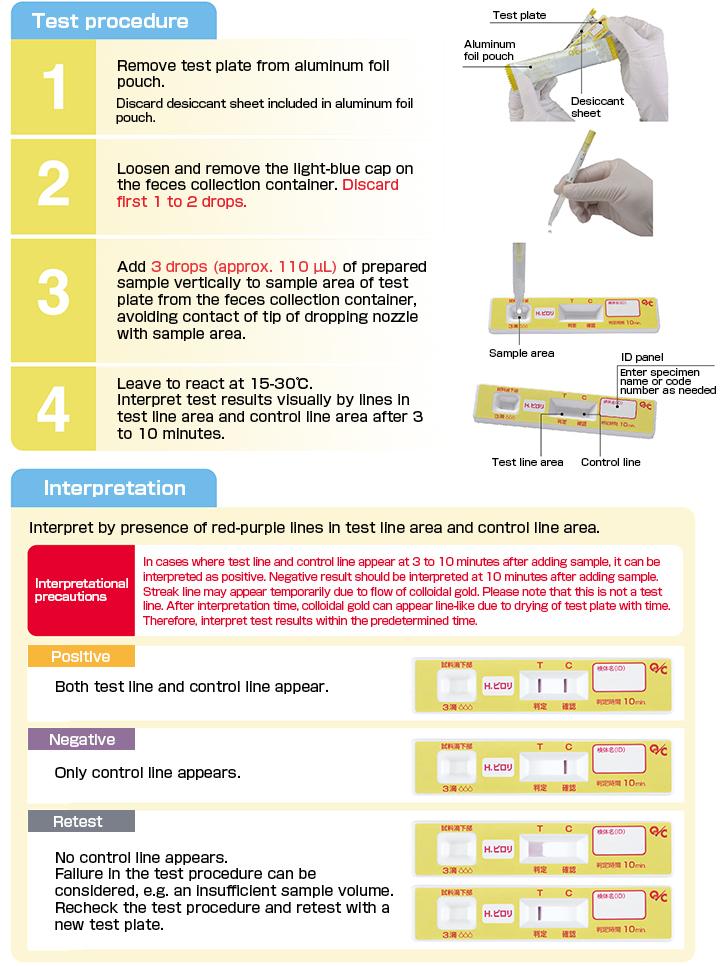 Test Procedure