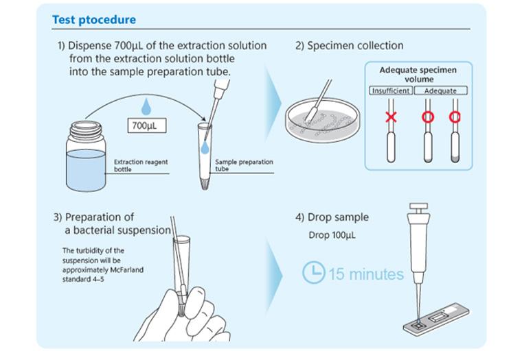 Test Procedure