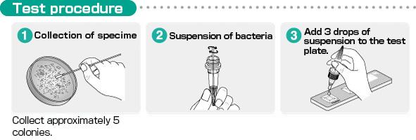 Test Procedure