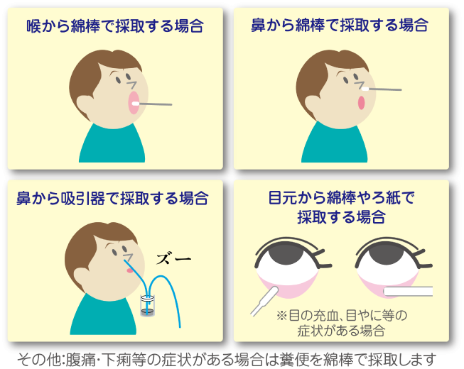 検査の材料を採取します