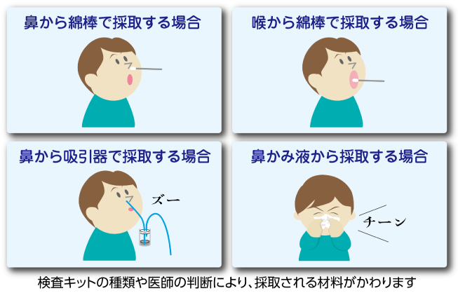 検査の材料を採取します