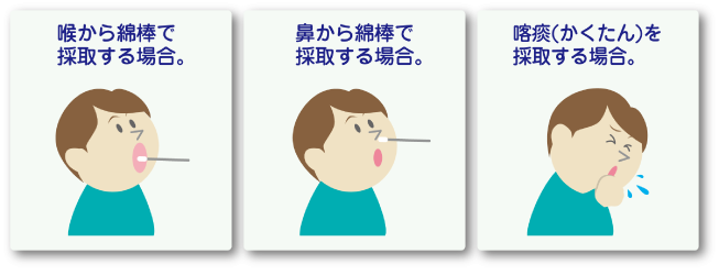 検査の材料を採取します