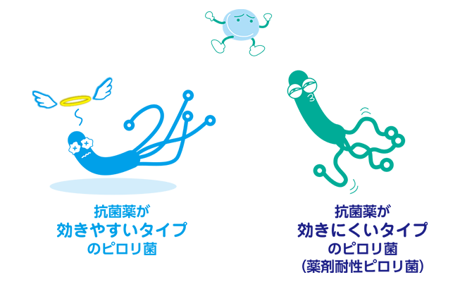 抗菌薬が効きやすいタイプと効きにくいタイプのピロリ菌