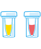 迅速ウレアーゼ試験