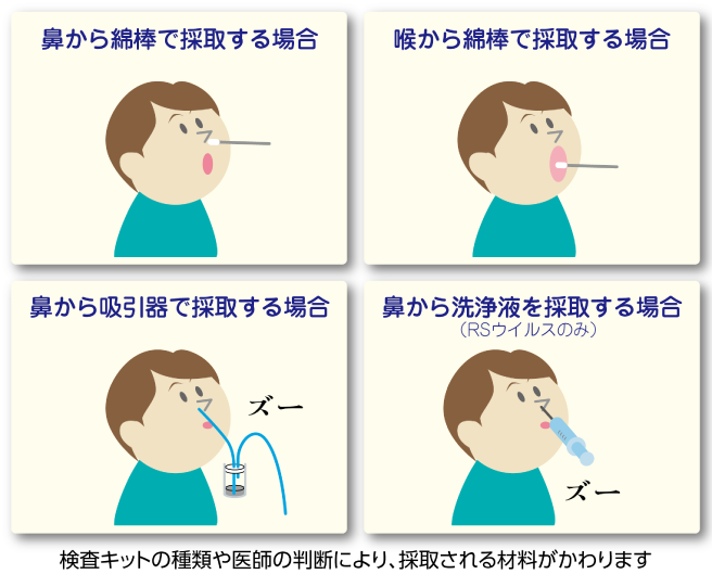 検査の材料を採取します