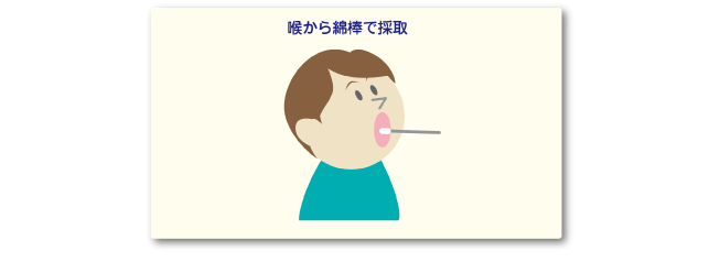 検査の材料を採取します