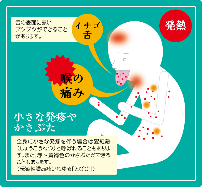 溶連菌感染症ってどんな病気?