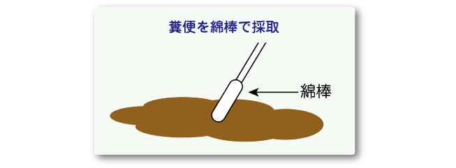 検査の材料を採取します